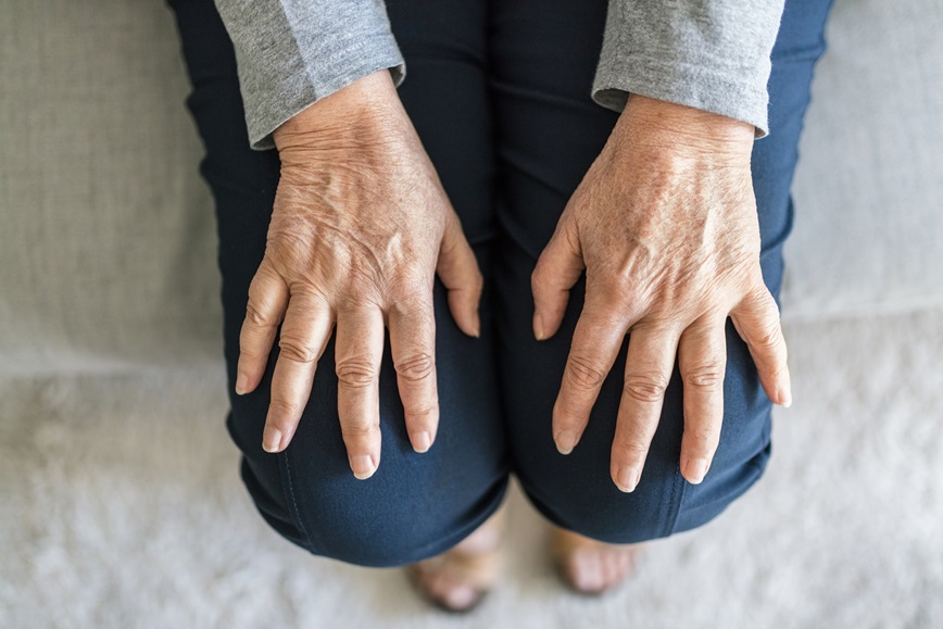 Rheumatologist and Arthritis Specialist in Queensland - Anna Arthritis Care